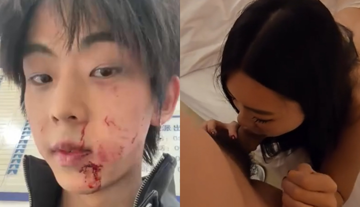 福建福州飢渴小富婆 包養男模被嫌棄逼臭 一怒之下將其打至毀容 兩人撕逼曝光大量聊天記錄與性愛視頻！